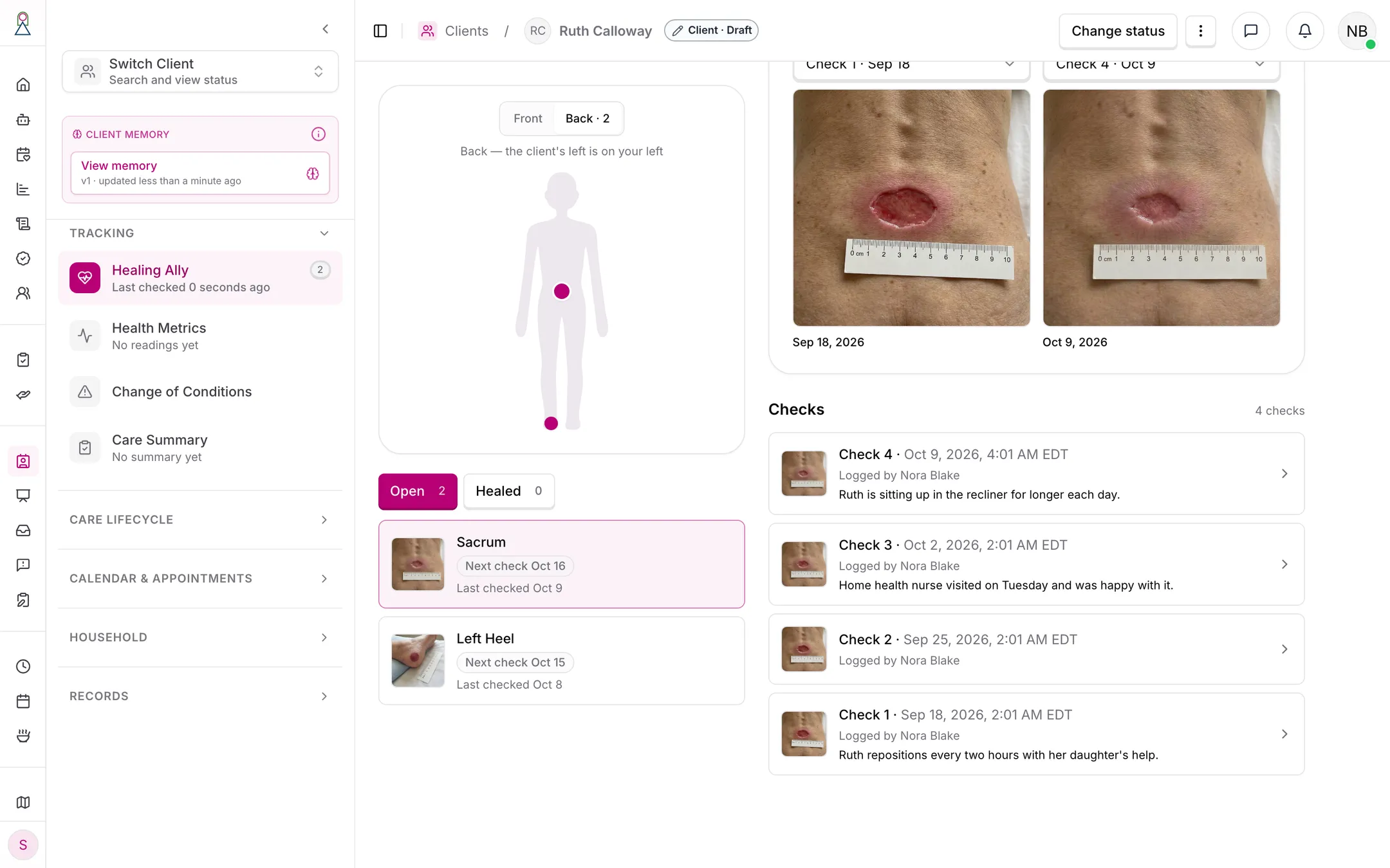 A wound's checks in order, each with its photo, who logged it and its notes