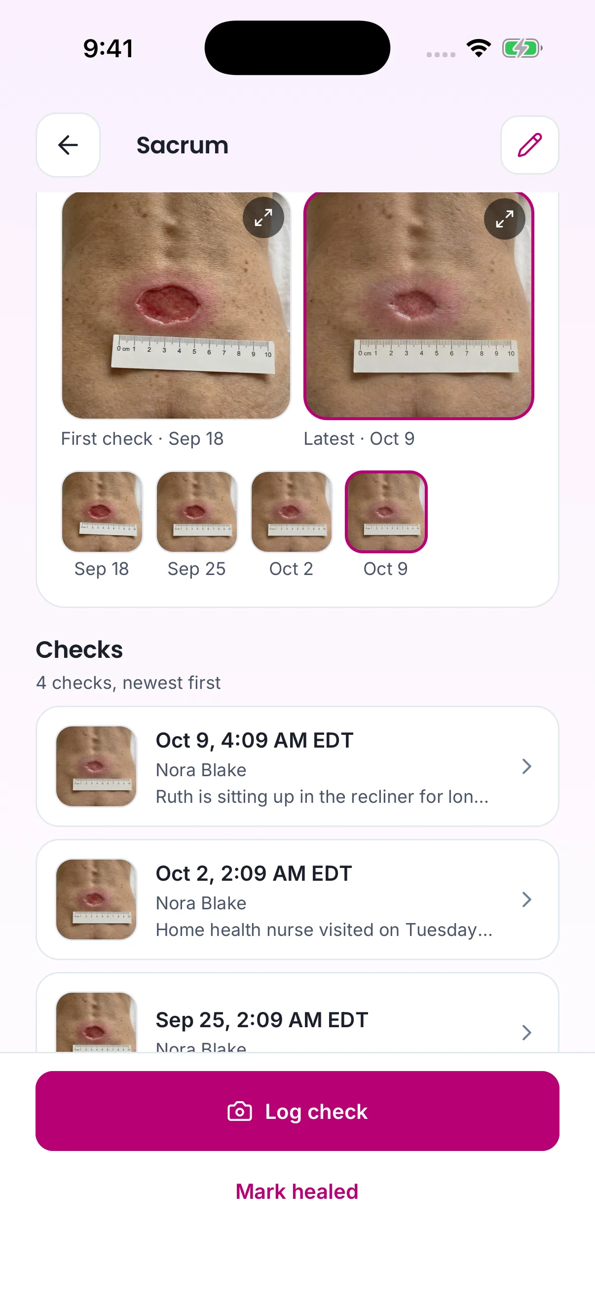 A wound on the phone: the first and latest photos side by side, every check's photo by date, and the checks listed newest first