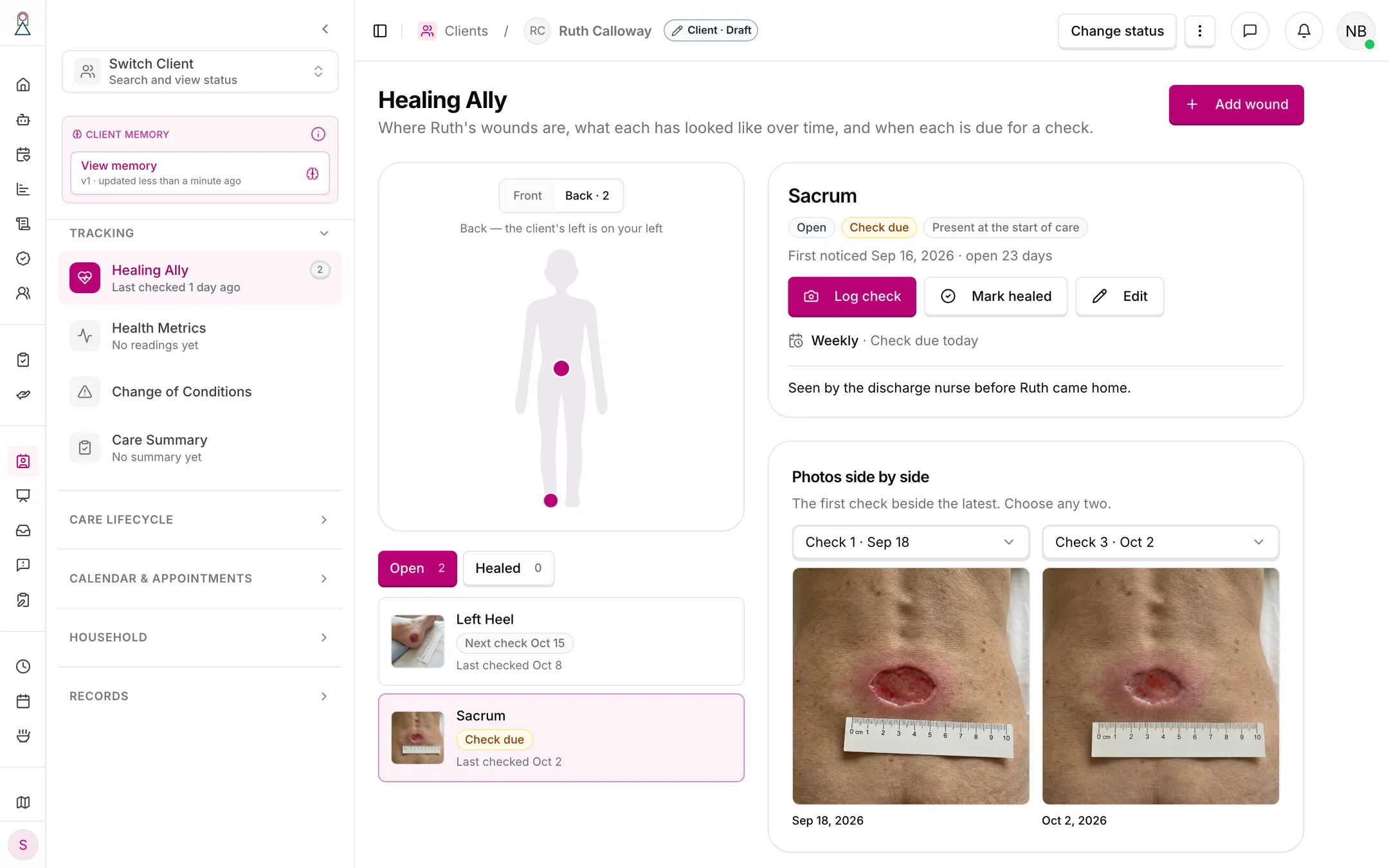A wound's page: where it came from, its weekly schedule, Log check, Mark healed and Edit, and its first and latest photos side by side