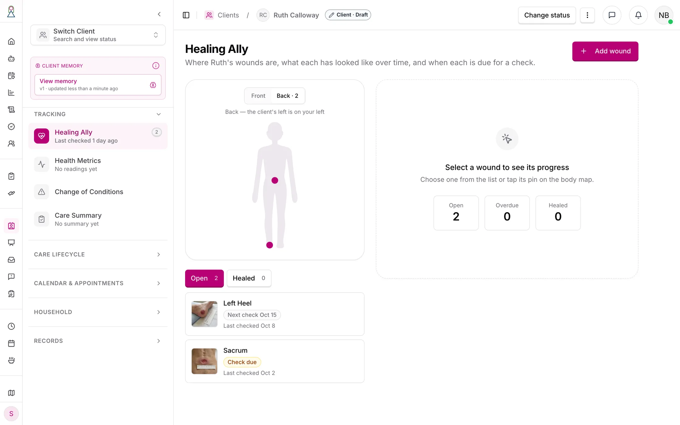 A client's Healing Ally: the back of the body map with two pins, the counts of open, overdue and healed wounds, and the list of wounds with their next check